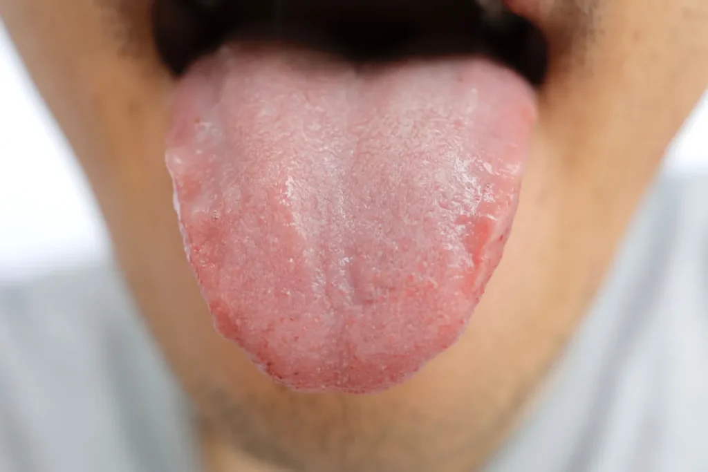 Bouton sur le sein